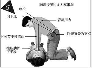 心跳驟停，教您急救方法