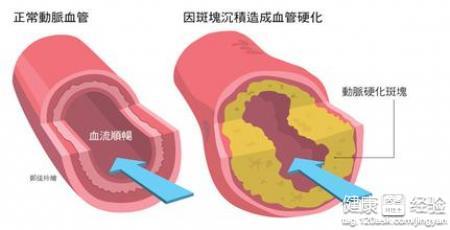 第1步