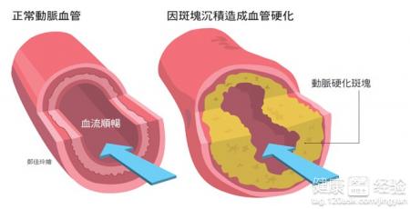 第1步