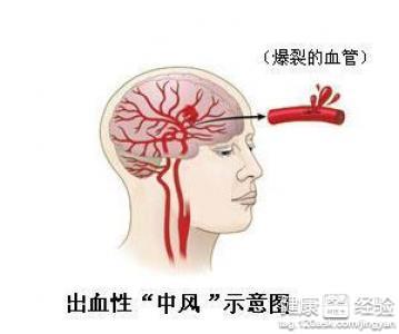 第1步