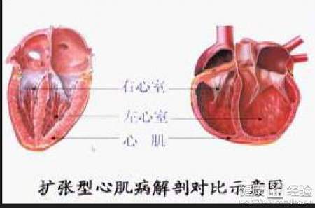 第1步