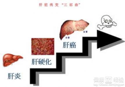 大三陽患者飲食上多吃什麼好