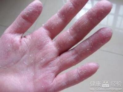 第1步