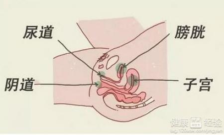 尿路感染怎麼辦?尿路感染不能吃什麼?