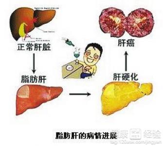 脂肪肝的實用藥膳食療