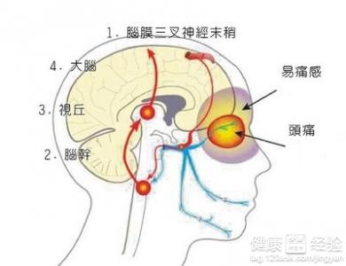 看看偏頭痛患者不適宜吃什麼