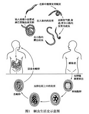 小兒腹痛或許是蛔蟲症引起